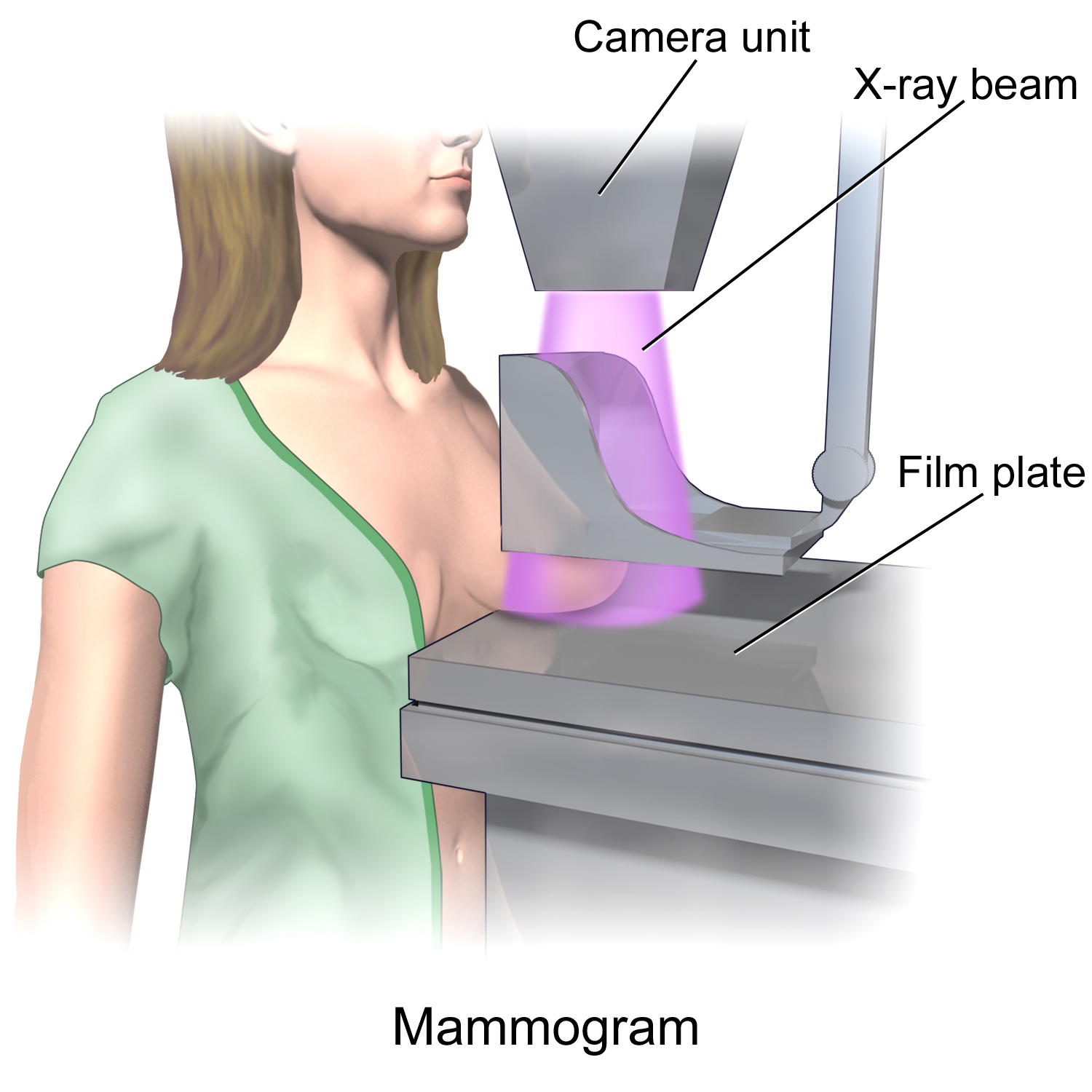 blausen 0628 mammogram