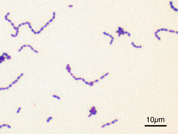 Streptococcus_mutans_Gram
